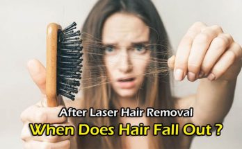 After Laser Hair Removal When Does Hair Fall Out, how do you kill hair follicles, back hair, what happens if you don't shave before laser hair removal, how long does it take for hair to grow back, does plucking kill hair follicles, electrolysis hair removal at home, epilation definition, how do you know if your hair follicles are dead, why is my hair still growing after laser hair removal, how do i prepare for laser hair removal, how do you stop hair from growing after shaving, laser light skin clinic, the light clinic, step up skin laser, hair growth chart, removal back hair, laser time, how many times do you have to wax before hair stops growing,
