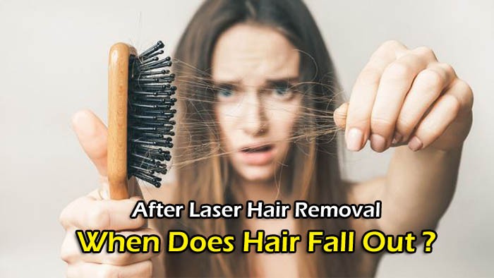 After Laser Hair Removal When Does Hair Fall Out, how do you kill hair follicles, back hair, what happens if you don't shave before laser hair removal, how long does it take for hair to grow back, does plucking kill hair follicles, electrolysis hair removal at home, epilation definition, how do you know if your hair follicles are dead, why is my hair still growing after laser hair removal, how do i prepare for laser hair removal, how do you stop hair from growing after shaving, laser light skin clinic, the light clinic, step up skin laser, hair growth chart, removal back hair, laser time, how many times do you have to wax before hair stops growing,
